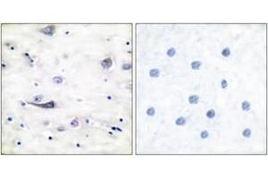 Immunohistochemistry analysis of paraffin-embedded human brain, using GluR1 (Phospho-Ser863) Antibody. (Glutamate Receptor 1 Antikörper  (pSer863))