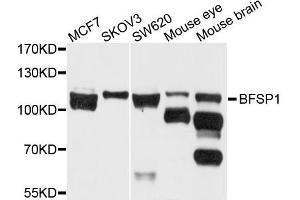 Western blot analysis of extract of various cells, using BFSP1 antibody. (Filensin Antikörper)