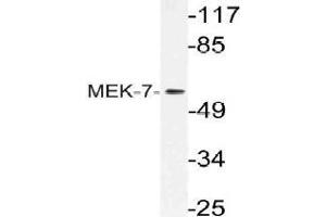 Western blot (WB) analysis of MEK-7 antibody in extracts from HeLa cells. (MAP2K7 Antikörper)