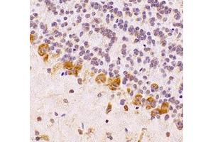 Immunohistochemistry (Paraffin-embedded Sections) (IHC (p)) image for anti-Ubiquinol-Cytochrome C Reductase Complex Chaperone (UQCC) antibody (ABIN7076094)