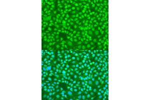 Immunofluorescence analysis of U2OS cells using SRSF9 antibody (ABIN6132650, ABIN6147681, ABIN6147684 and ABIN6216200) at dilution of 1:100.