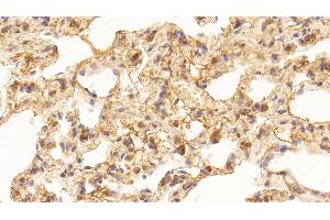 Immunohistochemistry (IHC) image for anti-Vascular Endothelial Growth Factor A (VEGFA) (AA 27-214) antibody (ABIN7428479)