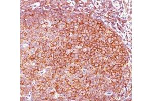 IHC staining of human tonsil with Bcl10 antibody (BL10/411). (BCL10 Antikörper  (AA 122-168))