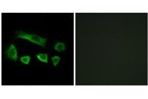 Immunofluorescence analysis of A549 cells, using NT5C1B antibody. (NT5C1B Antikörper  (Internal Region))