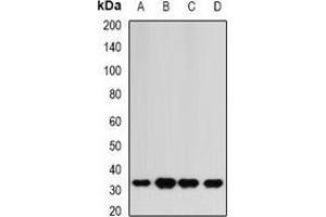 Western blot analysis of HAGH expression in HepG2 (A), mouse liver (B), mouse heart (C), rat kidney (D) whole cell lysates. (HAGH Antikörper)