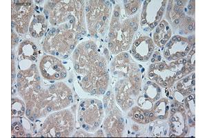Immunohistochemical staining of paraffin-embedded liver tissue using anti-SERPINA1mouse monoclonal antibody. (SERPINA1 Antikörper)