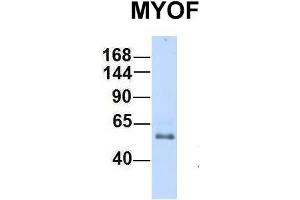 Host:  Rabbit  Target Name:  MYOF  Sample Type:  Human Fetal Heart  Antibody Dilution:  1.