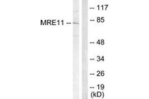 Western blot analysis of extracts from Jurkat cells, treated with UV 15', using MRE11 (Ab-264) Antibody. (Mre11 Antikörper  (AA 230-279))