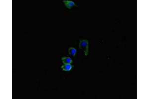 Immunofluorescent analysis of HepG2 cells using ABIN7169164 at dilution of 1:100 and Alexa Fluor 488-congugated AffiniPure Goat Anti-Rabbit IgG(H+L) (ACVRL1 Antikörper  (AA 22-118))