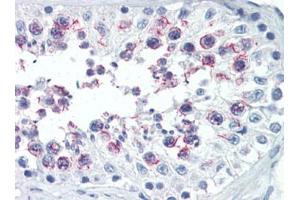 Human Testis (formalin-fixed, paraffin-embedded) stained with SMURF1followed by biotinylated goat anti-rabbit IgG secondary antibody, alkaline phosphatase-streptavidin and chromogen. (SMURF1 Antikörper  (N-Term))