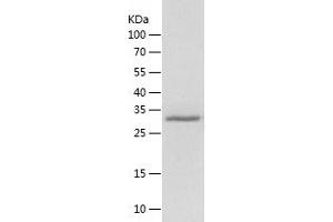 Western Blotting (WB) image for Carboxypeptidase B1 (Tissue) (CPB1) (AA 109-415) protein (His tag) (ABIN7122141) (CPB1 Protein (AA 109-415) (His tag))