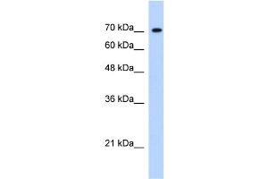 WB Suggested Anti-JMJD3 Antibody Titration:  1.