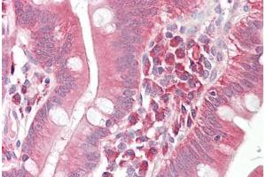 Anti-GAD67 antibody IHC staining of human small intestine.