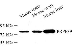 Western blot analysis of PRPF39 (ABIN7075170) at dilution of 1: 500 (PRPF39 Antikörper)