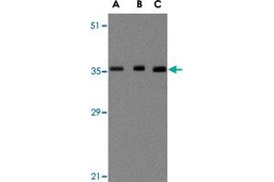 Western blot analysis of BRCC3 in MCF-7 cell lysate with BRCC3 polyclonal antibody  at (A) 0. (BRCC3 Antikörper  (N-Term))