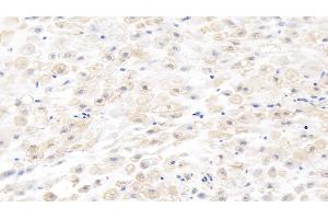 Detection of MMP8 in Human Placenta Tissue using Monoclonal Antibody to Matrix Metalloproteinase 8 (MMP8) (MMP8 Antikörper  (AA 101-467))