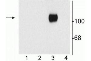Western blot of 10 µg of HEK 293 cells showing specific immunolabeling of the ~120 kDa NR1 subunit of the NMDA receptor containing the C1 splice variant insert (in lane 3). (GRIN1/NMDAR1 Antikörper)