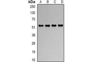 Western blot analysis of RbAp48 expression in Hela (A), Jurkat (B), NIH3T3 (C), COS7 (D) whole cell lysates. (Retinoblastoma Binding Protein 4 Antikörper)