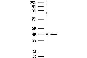 Western blot analysis of lysates from MDA-MB-231 cells(heat-shock,45 min treatment), using SORD Antibody at 1/1000 dilution.