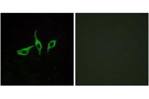 Immunofluorescence analysis of LOVO cells, using GPR120 Antibody. (O3FAR1 Antikörper  (AA 221-270))