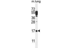 Western Blotting (WB) image for anti-Chromosome 14 Open Reading Frame 126 (C14orf126) antibody (ABIN2995710) (C14orf126 Antikörper)