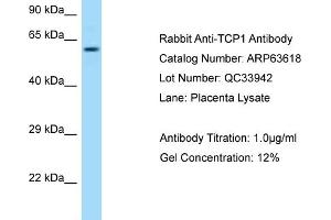 Western Blotting (WB) image for anti-T-Complex 1 (TCP1) (C-Term) antibody (ABIN2789568)