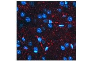 BACE1 antibody used at a concentration of 2-10 ug/ml to detect astrocytes in rodent brain (red).