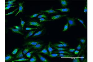Immunofluorescence (IF) image for anti-Ubiquinol-Cytochrome C Reductase Core Protein II (UQCRC2) (AA 1-453) antibody (ABIN521273)