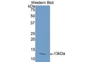 Western blot analysis of the recombinant protein. (Activin A Receptor Type IB/ALK-4 Antikörper  (AA 24-126))