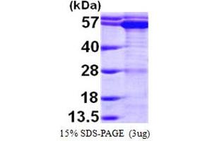 SDS-PAGE (SDS) image for T-Complex 1 (TCP1) (AA 1-556) protein (His tag) (ABIN7529160) (TCP1 alpha/CCTA Protein (AA 1-556) (His tag))