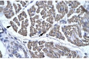 Human Skeletal Muscle; EYA3 antibody - middle region in Human Skeletal Muscle cells using Immunohistochemistry (EYA3 Antikörper  (Middle Region))