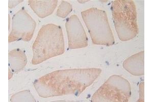 Detection of BMP15 in Rat Skeletal muscle Tissue using Polyclonal Antibody to Bone Morphogenetic Protein 15 (BMP15)
