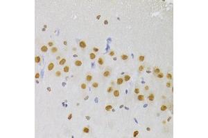 Immunohistochemistry of paraffin-embedded rat brain using HNRNPA1 Antibody (ABIN5975570) at dilution of 1/100 (40x lens). (HNRNPA1 Antikörper)