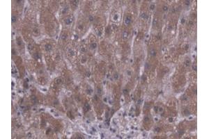 IHC-P analysis of Human Liver Tissue, with DAB staining. (CES1 Antikörper  (AA 18-299))