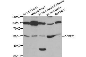 Western Blotting (WB) image for anti-Pyruvate Dehydrogenase Phosphatase (PDP) antibody (ABIN1980348) (PDP Antikörper)