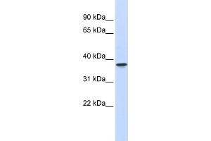 WB Suggested Anti-THOC6 Antibody Titration:  0. (THOC6 Antikörper  (Middle Region))
