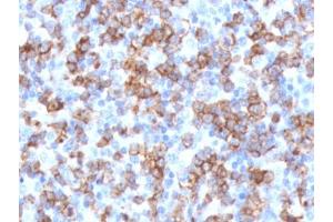 IHC testing of FFPE human tonsil with recombinant CD8 antibody (clone CDLA8a-2R).