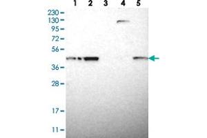 Western blot analysis of Lane 1: RT-4, Lane 2: U-251 MG, Lane 3: Human Plasma, Lane 4: Liver, Lane 5: Tonsil with TMED2 polyclonal antibody  at 1:250-1:500 dilution. (TMED2 Antikörper)