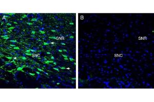 Expression of Tetraspanin 7 in the rat substantia nigra region.