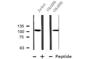 Western blot analysis of extracts from Jurkat/COLO205 cells, using MBTPS1 antibody.