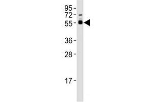 Western blot testing of SMAD3 antibody at 1:1000 dilution + mouse brain lysate