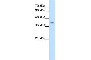 Western Blotting (WB) image for anti-Wingless-Type MMTV Integration Site Family, Member 2B (WNT2B) (N-Term) antibody (ABIN2776723)