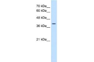 WB Suggested Anti-WNT2B Antibody Titration:  0. (WNT2B Antikörper  (N-Term))