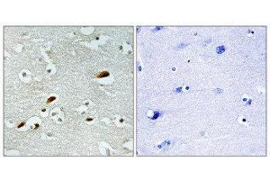 Immunohistochemistry (IHC) image for anti-K(lysine) Acetyltransferase 5 (KAT5) (Internal Region) antibody (ABIN1849869) (KAT5 Antikörper  (Internal Region))