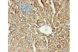 Anti-MTCO1 antibody, IHC(P): Mouse Liver Tissue (COX1 Antikörper  (C-Term))