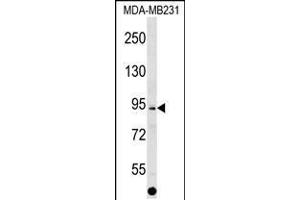 Western blot analysis in MDA-MB231 cell line lysates (35ug/lane). (ALS2CL Antikörper  (AA 349-377))
