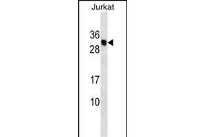 HLA-DMB Antibody (Center) (ABIN1537808 and ABIN2849547) western blot analysis in Jurkat cell line lysates (35 μg/lane). (HLA-DMB Antikörper  (AA 127-154))