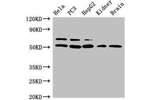 Western Blot Positive WB detected in: Hela whole cell lysate, PC-3 whole cell lysate, HepG2 whole cell lysate, Mouse kidney tissue, Mouse brain tissue All lanes: NR5A2 antibody at 3 μg/mL Secondary Goat polyclonal to rabbit IgG at 1/50000 dilution Predicted band size: 62, 57, 43, 54 kDa Observed band size: 62, 54 kDa (NR5A2 + LRH1 Antikörper  (AA 182-291))