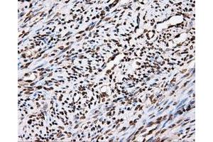 Immunohistochemical staining of paraffin-embedded Kidney tissue using anti-APP mouse monoclonal antibody. (APP Antikörper)