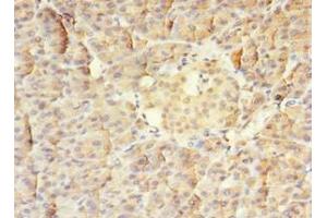 Immunohistochemistry of paraffin-embedded human pancreatic tissue using ABIN7159585 at dilution of 1:100 (MTR Antikörper  (AA 923-1265))